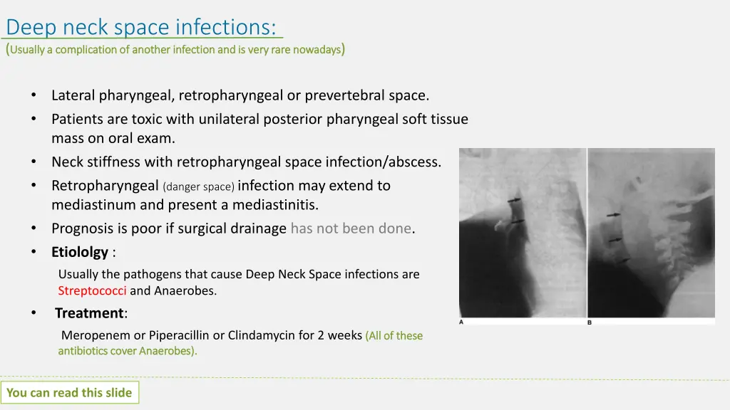 deep neck space infections usually a complication