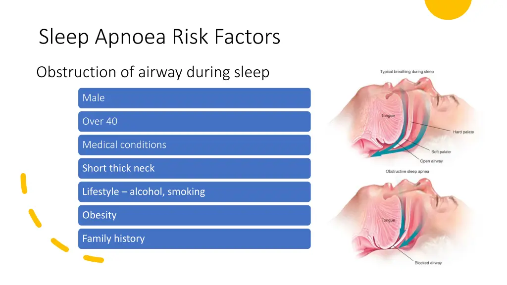 sleep apnoea risk factors