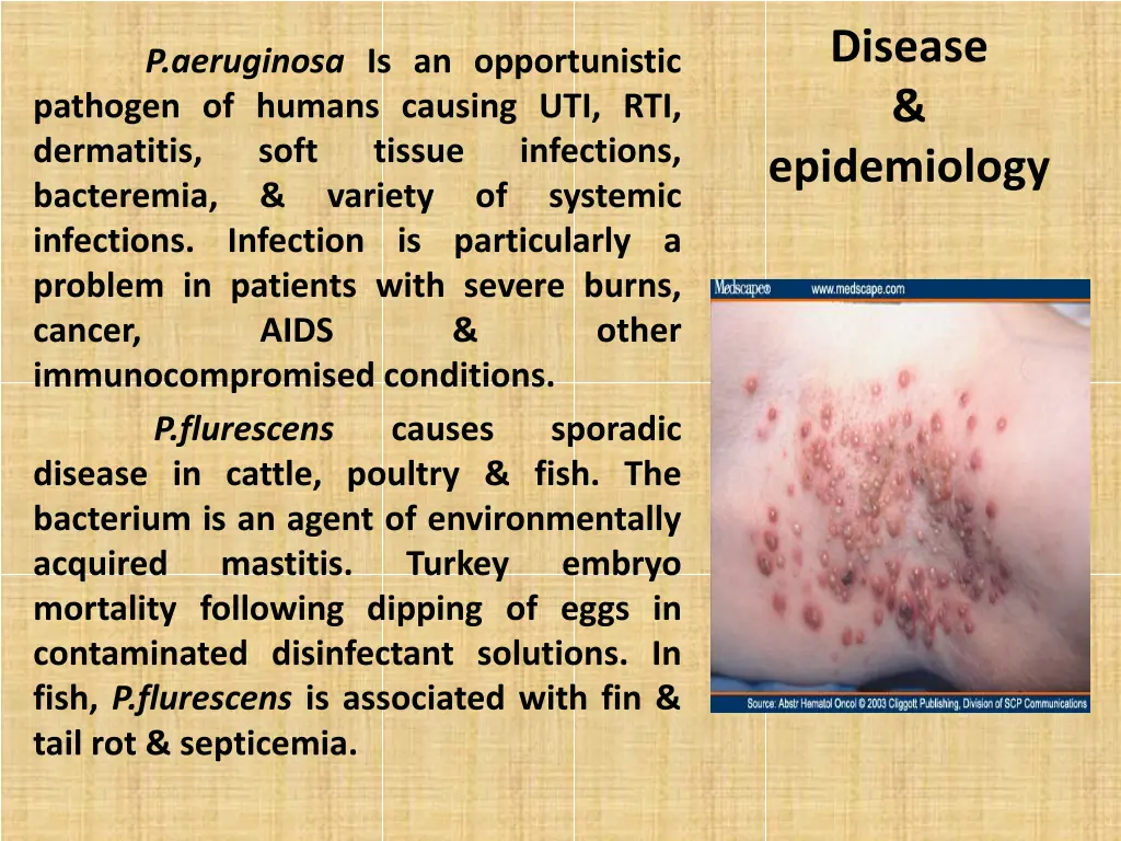 disease epidemiology