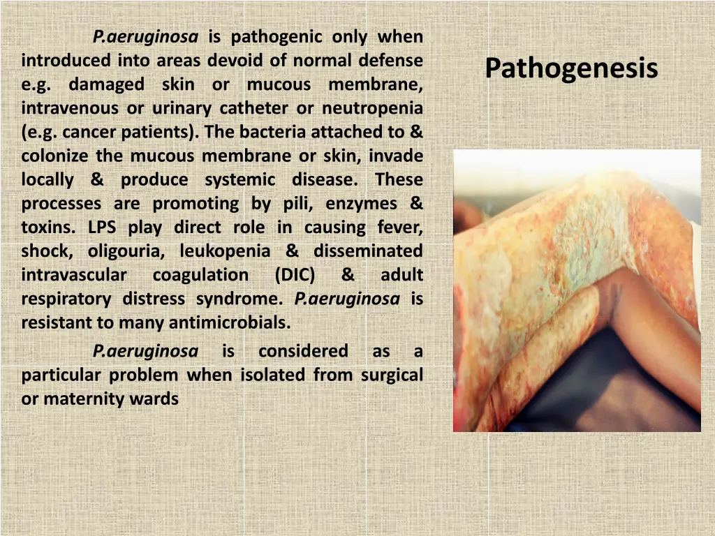 p aeruginosa is pathogenic only when introduced