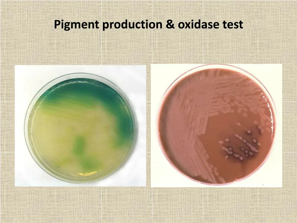 pigment production oxidase test