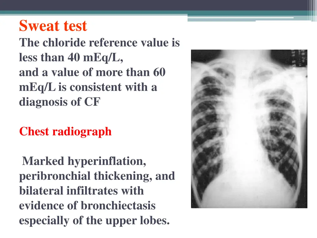 sweat test the chloride reference value is less