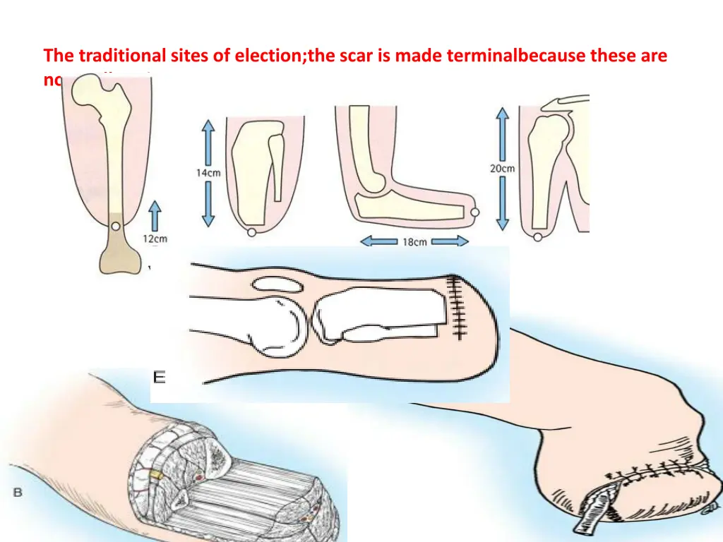 the traditional sites of election the scar