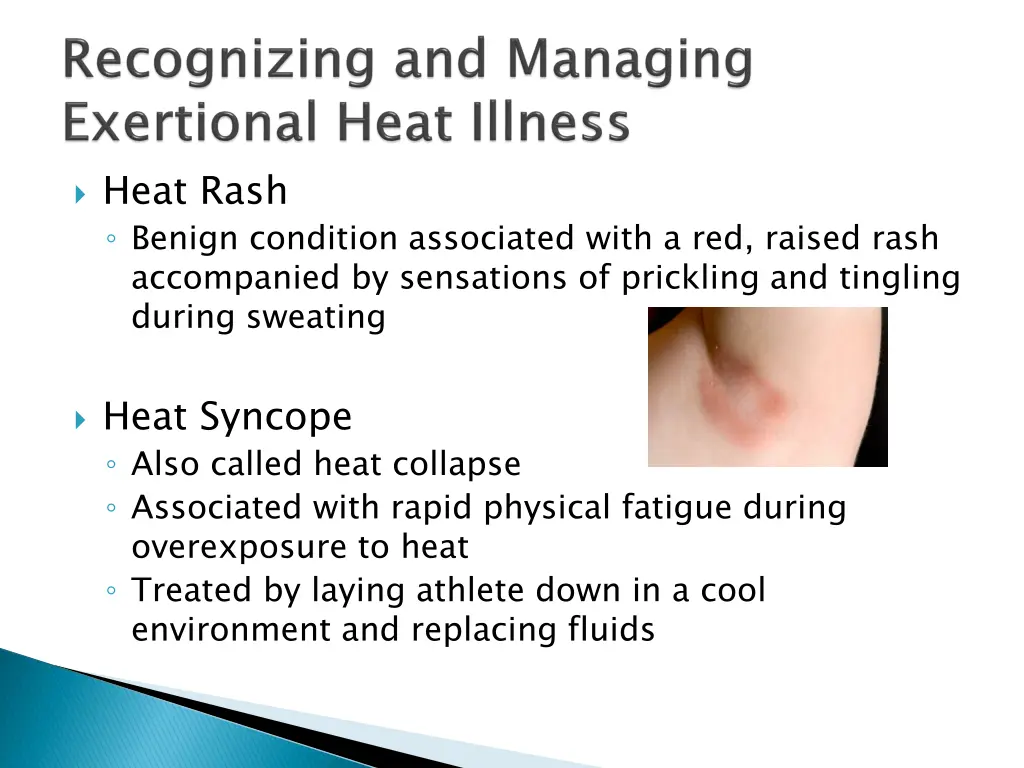 heat rash benign condition associated with