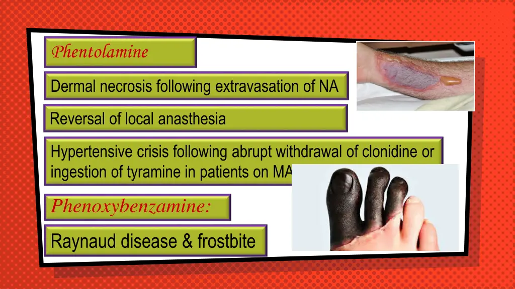 phentolamine