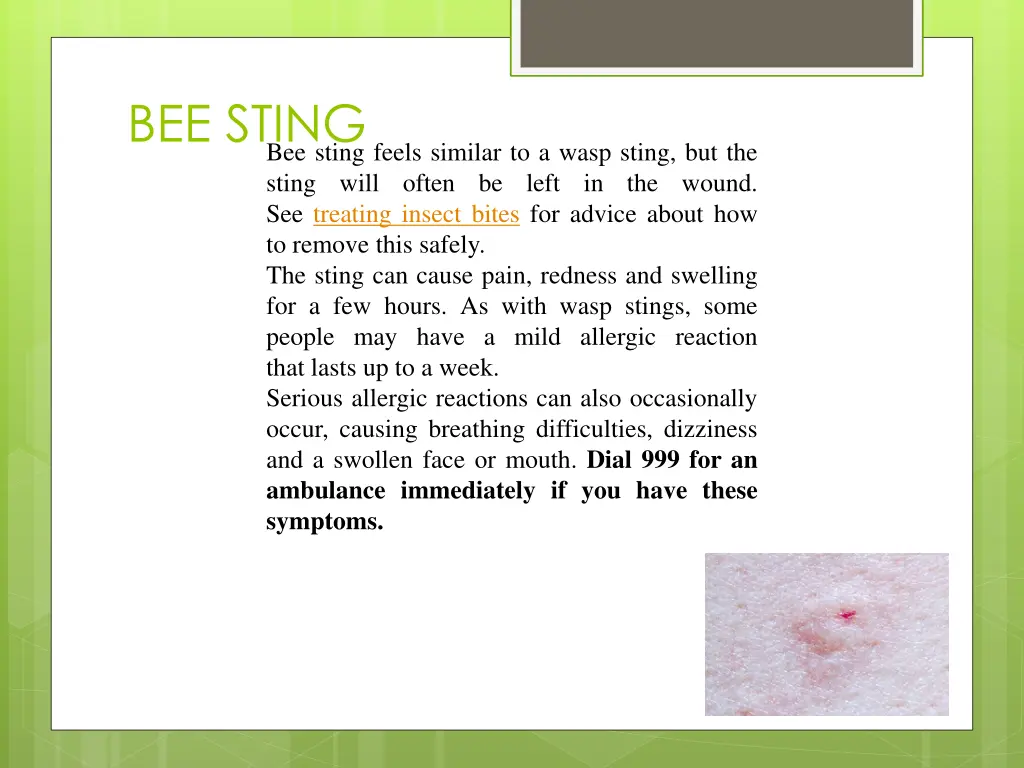 bee sting