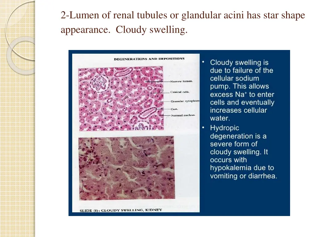 2 lumen of renal tubules or glandular acini