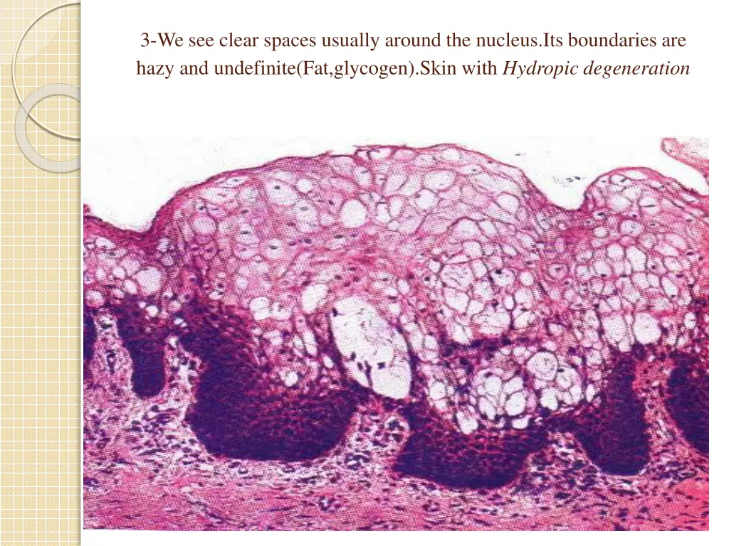 3 we see clear spaces usually around the nucleus