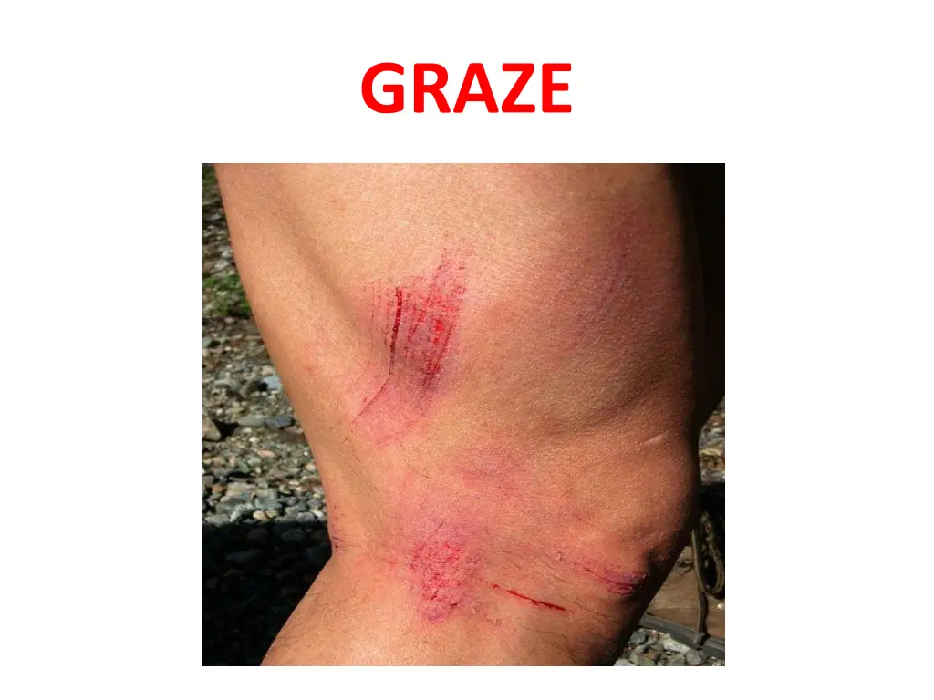 graze 1