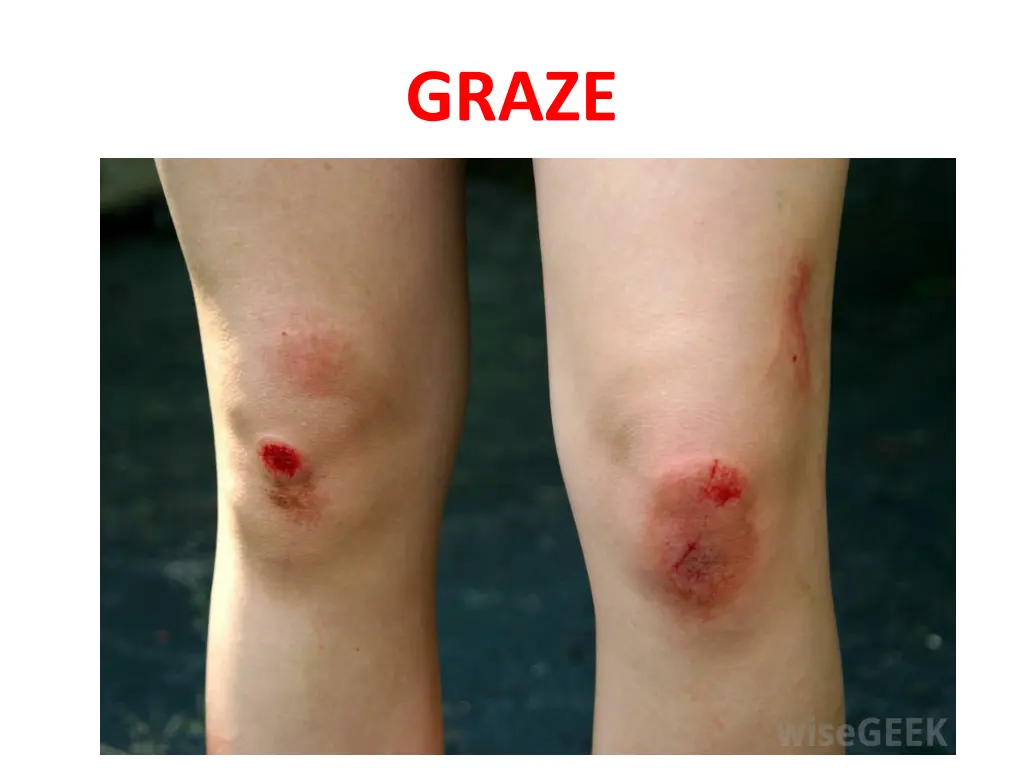 graze 2