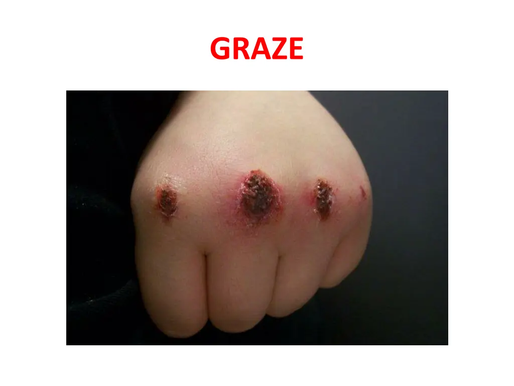 graze 3