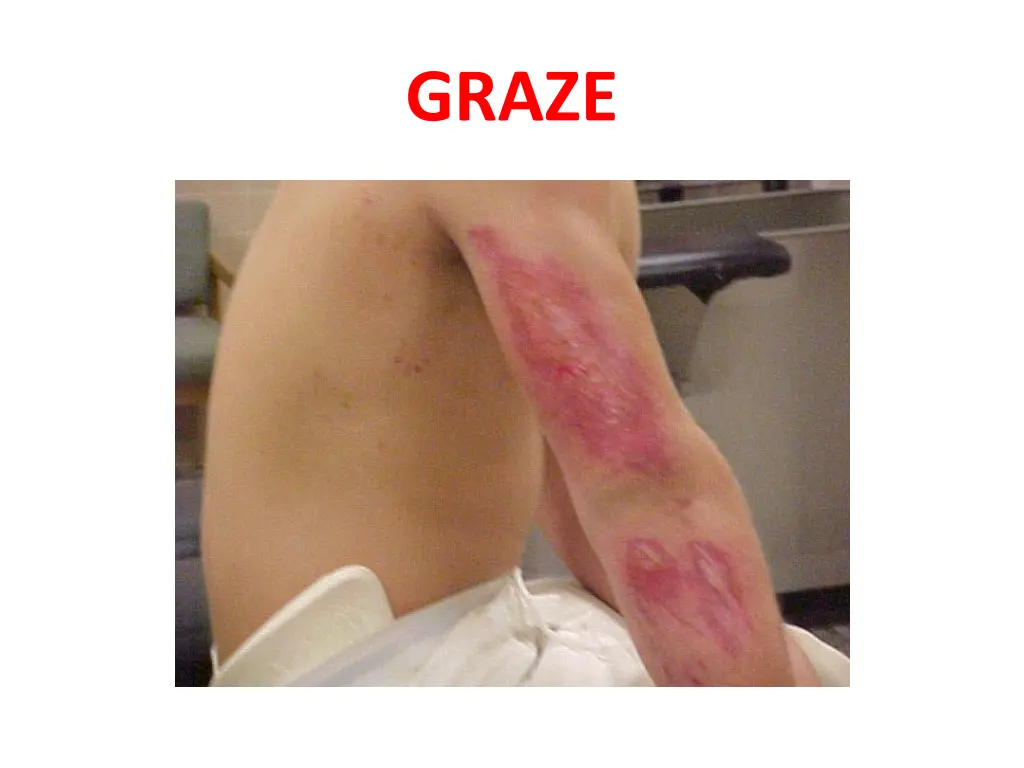 graze