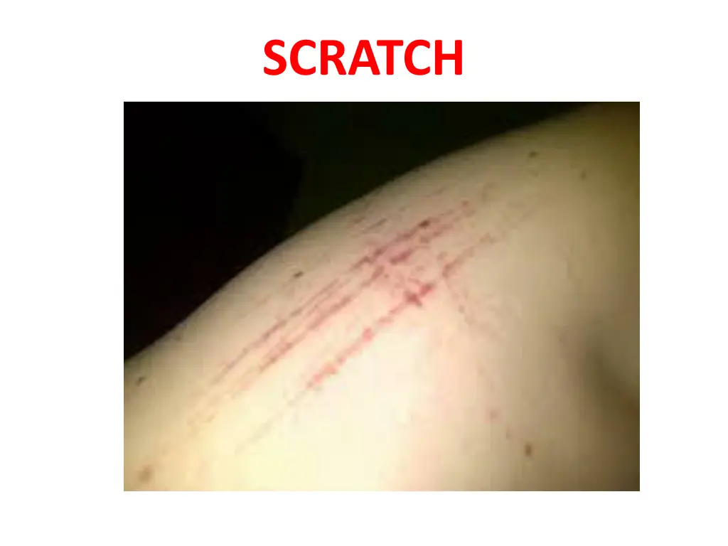 scratch