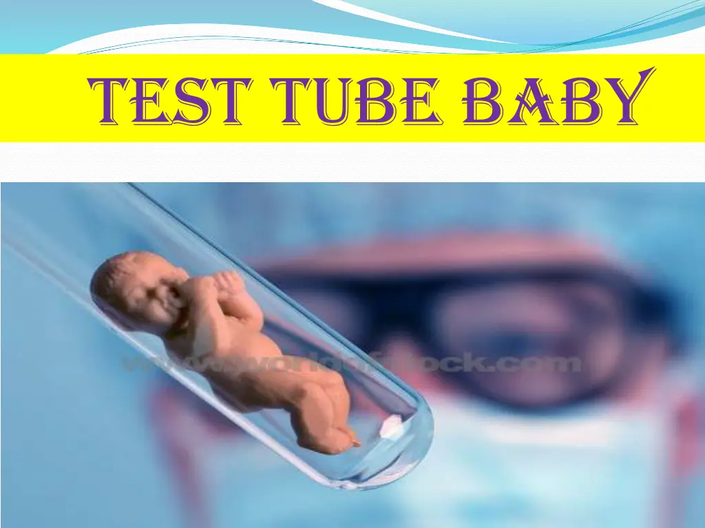 test tube baby