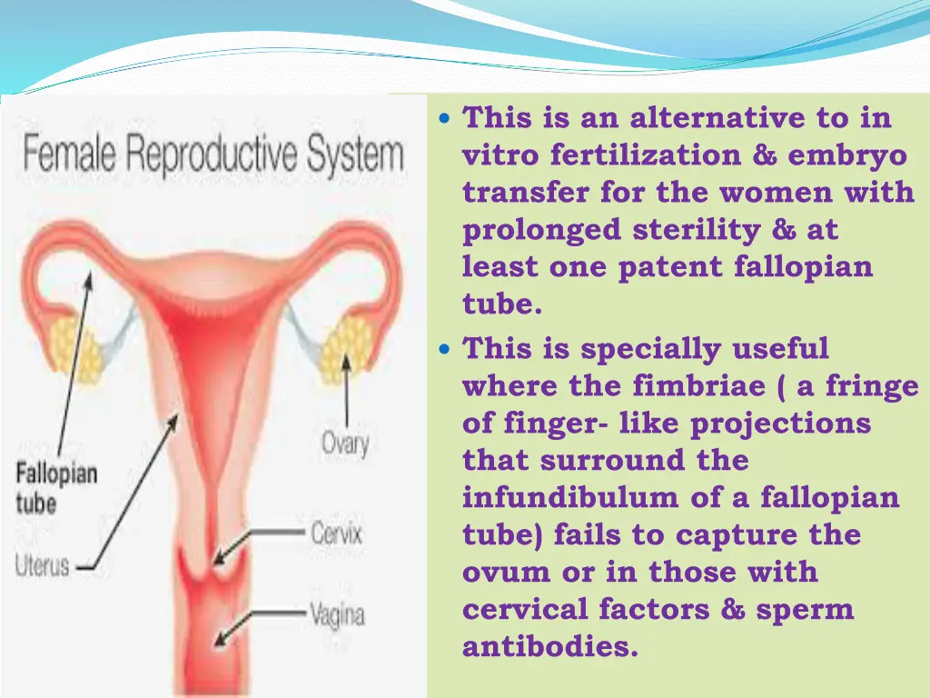 this is an alternative to in vitro fertilization