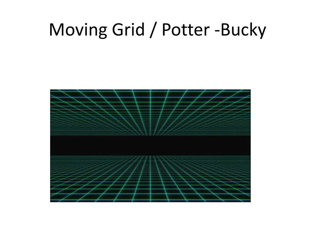 moving grid potter bucky