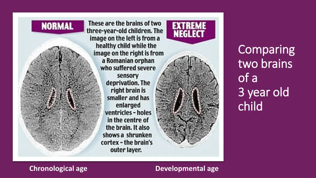 comparing comparing two brains two brains