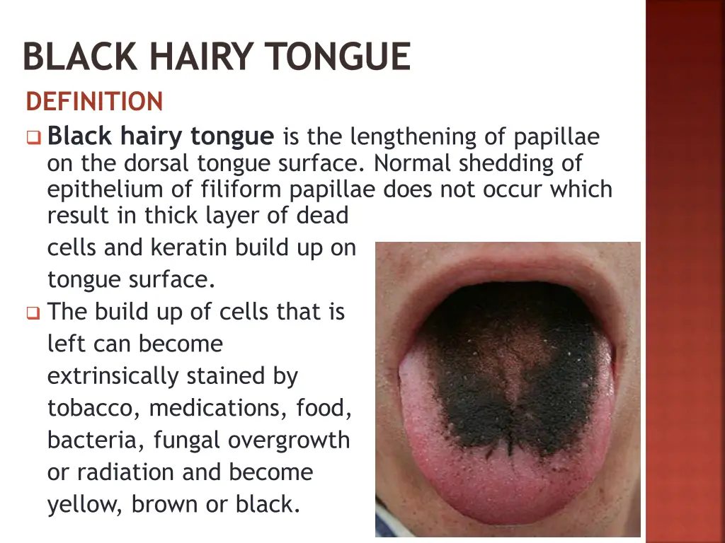 black hairy tongue definition black hairy tongue