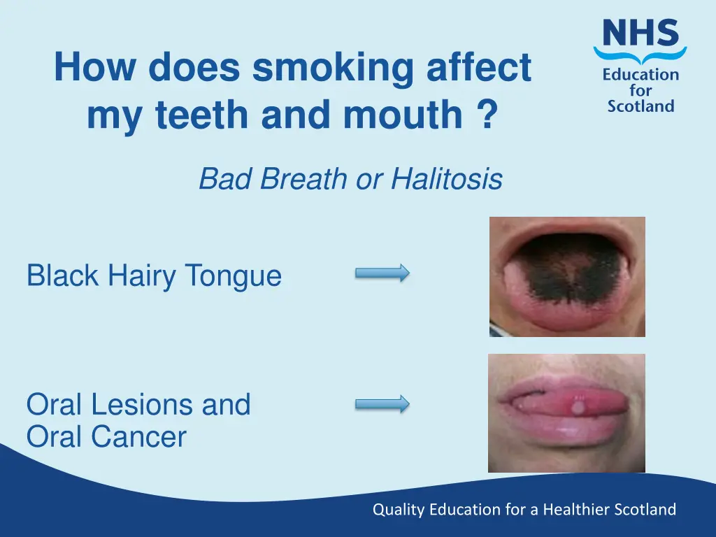 how does smoking affect my teeth and mouth 1