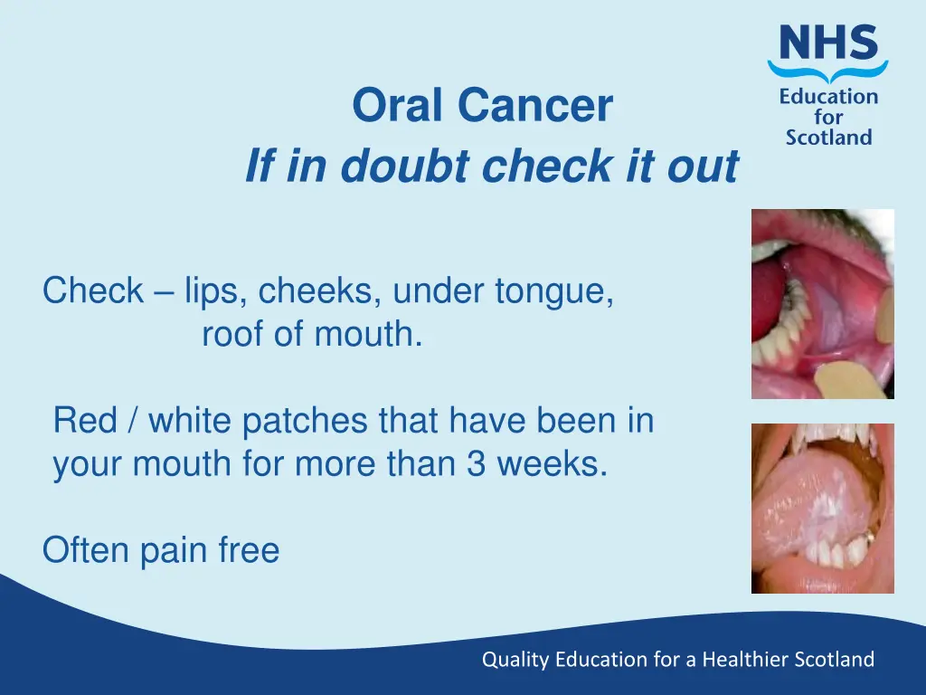 oral cancer if in doubt check it out