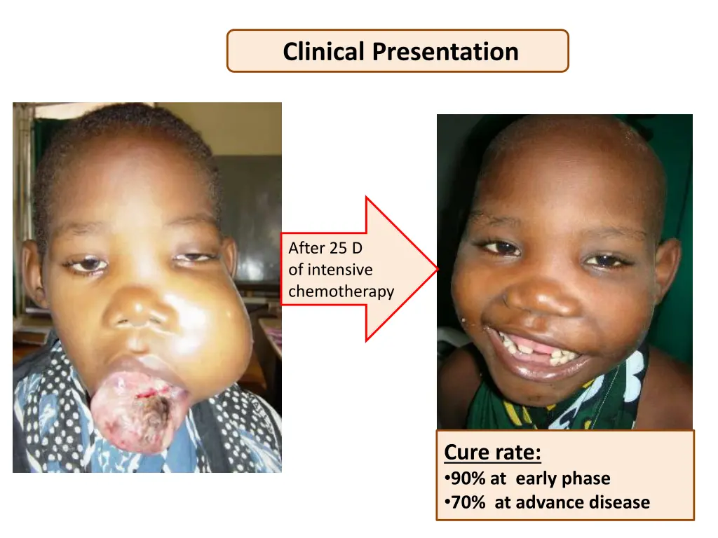 clinical presentation