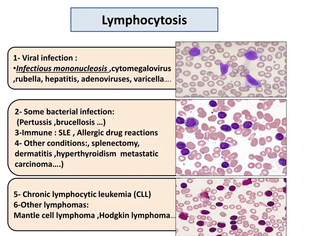 lymphocytosis