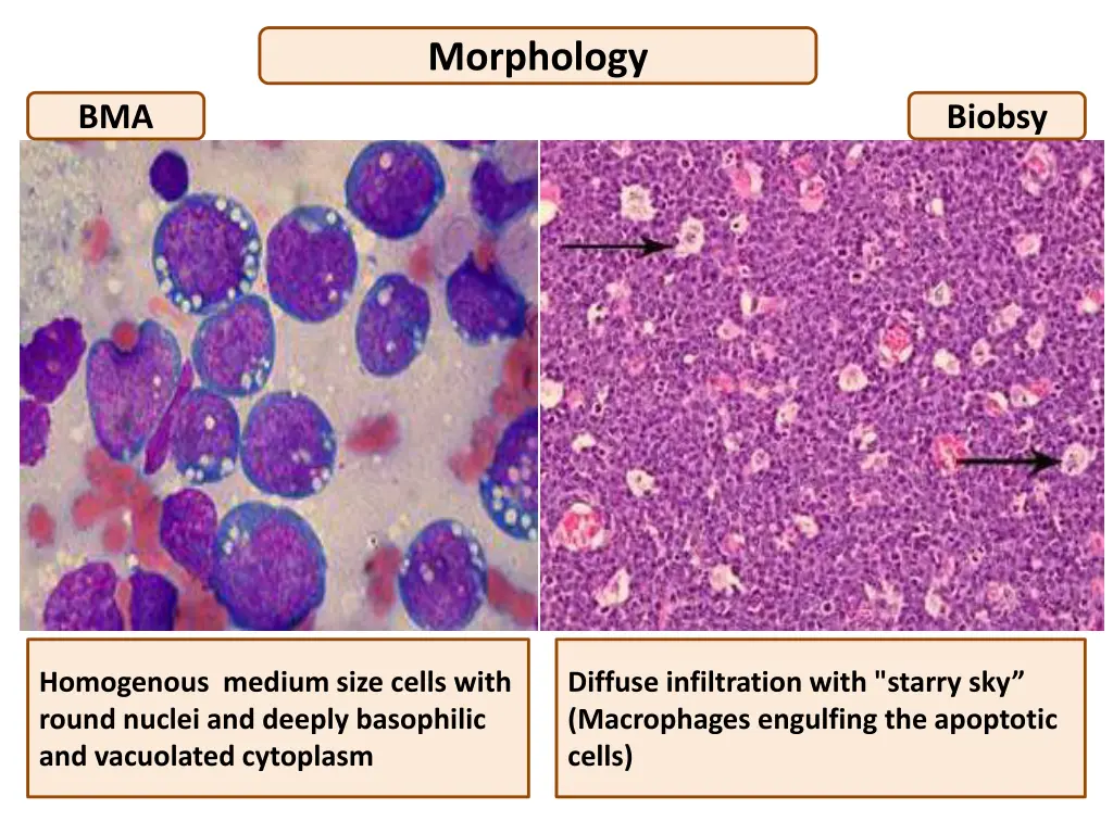 morphology