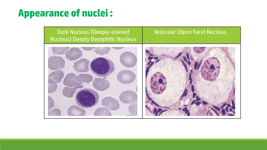 appearance of nuclei