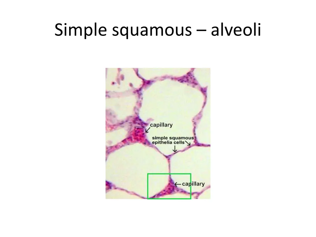 simple squamous alveoli 1