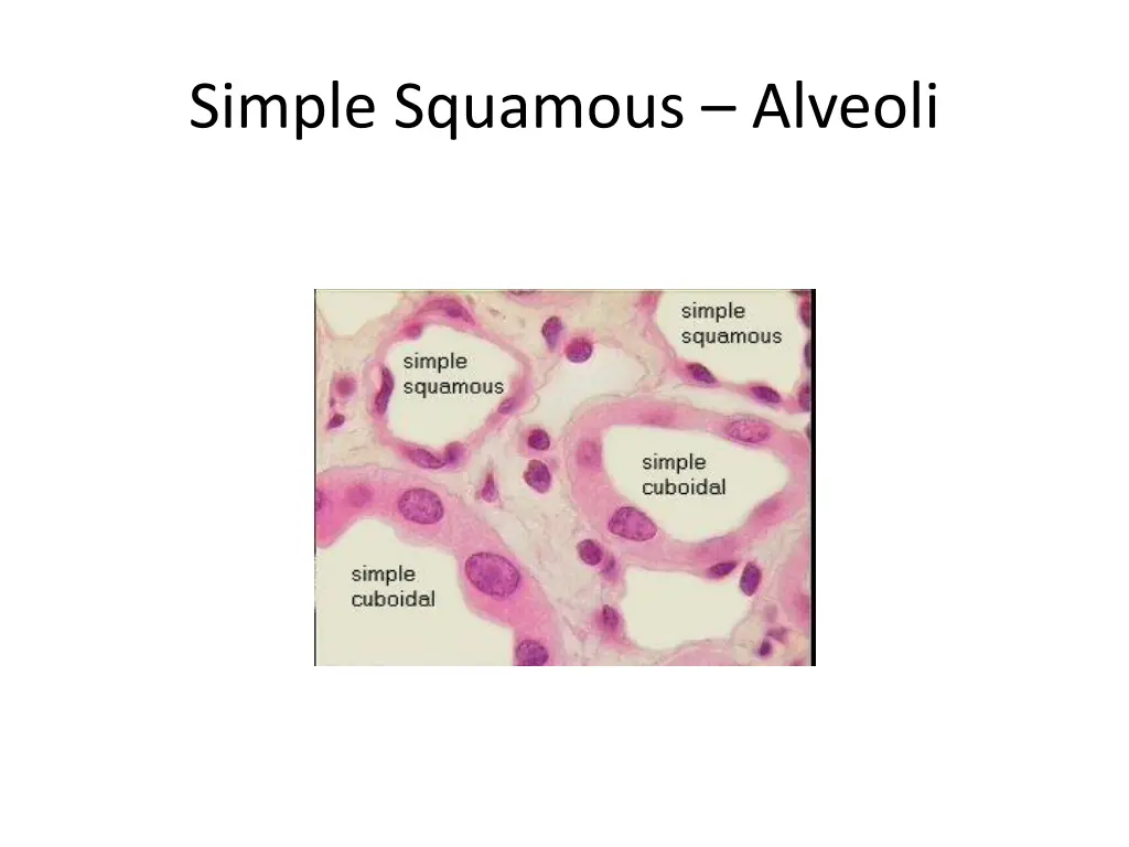 simple squamous alveoli