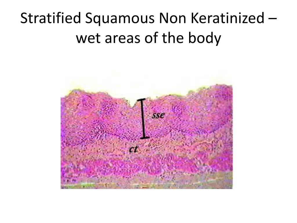 stratified squamous non keratinized wet areas