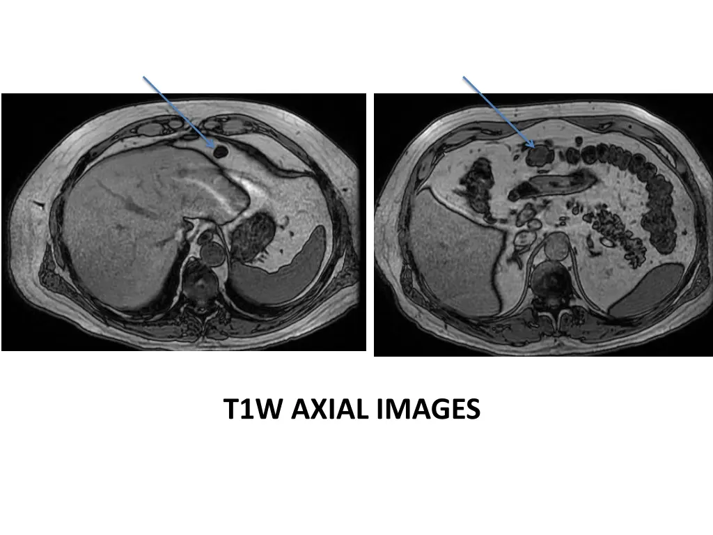 t1w axial images