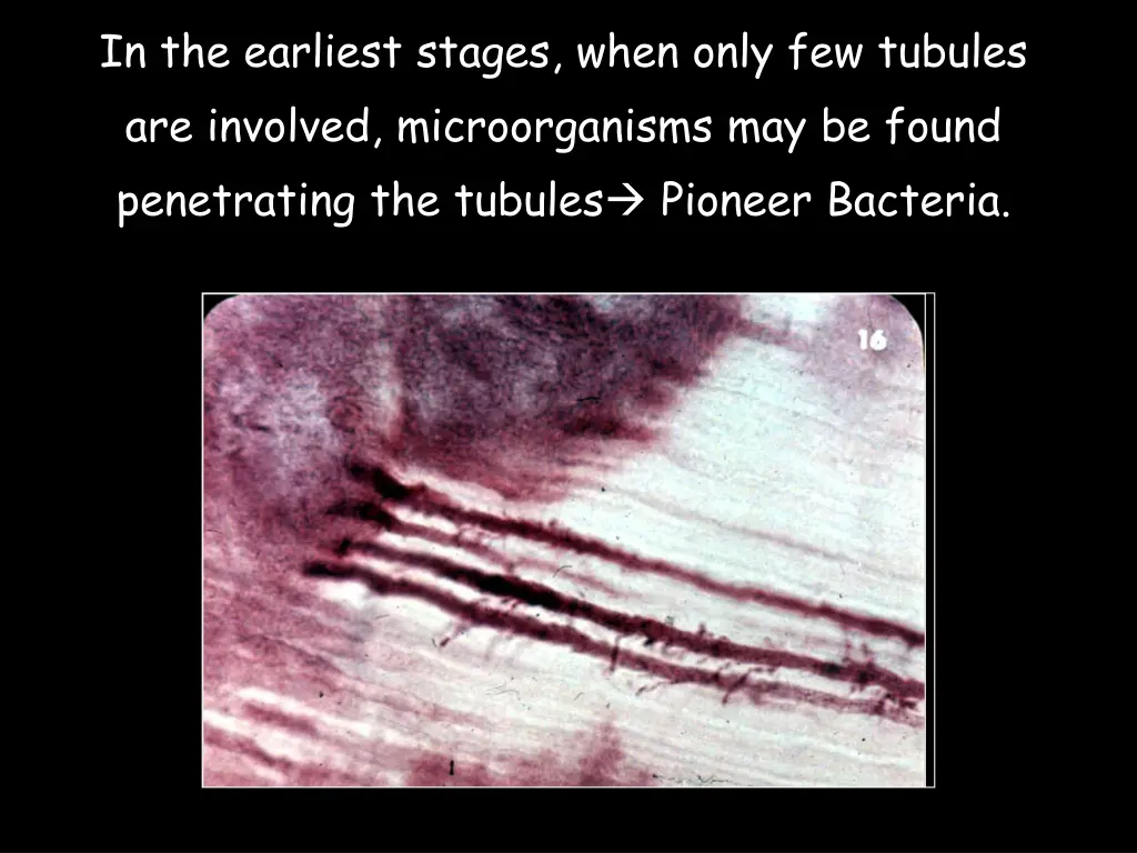 in the earliest stages when only few tubules