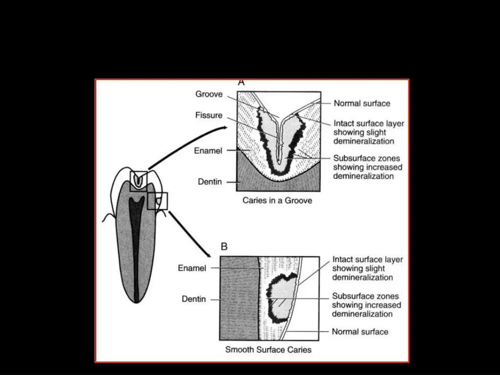 slide10