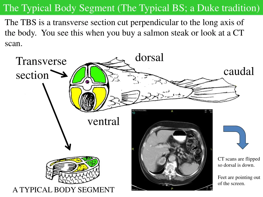 the typical body segment the typical bs a duke 1