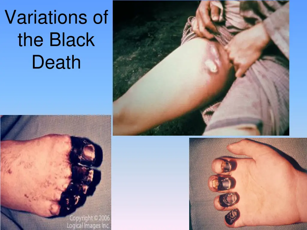 variations of the black death