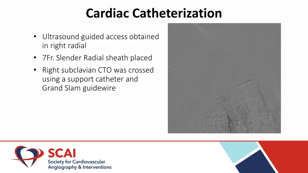 cardiac catheterization 1