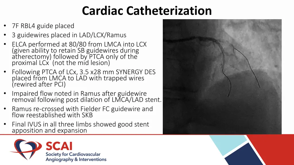 cardiac catheterization 2