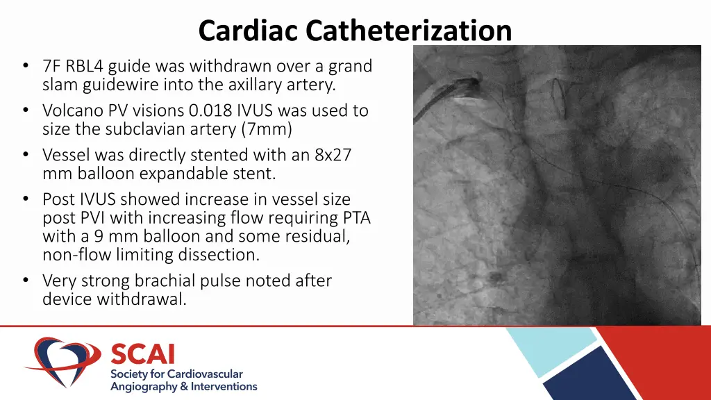 cardiac catheterization 3