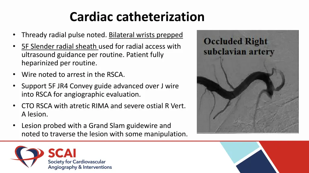 cardiac catheterization