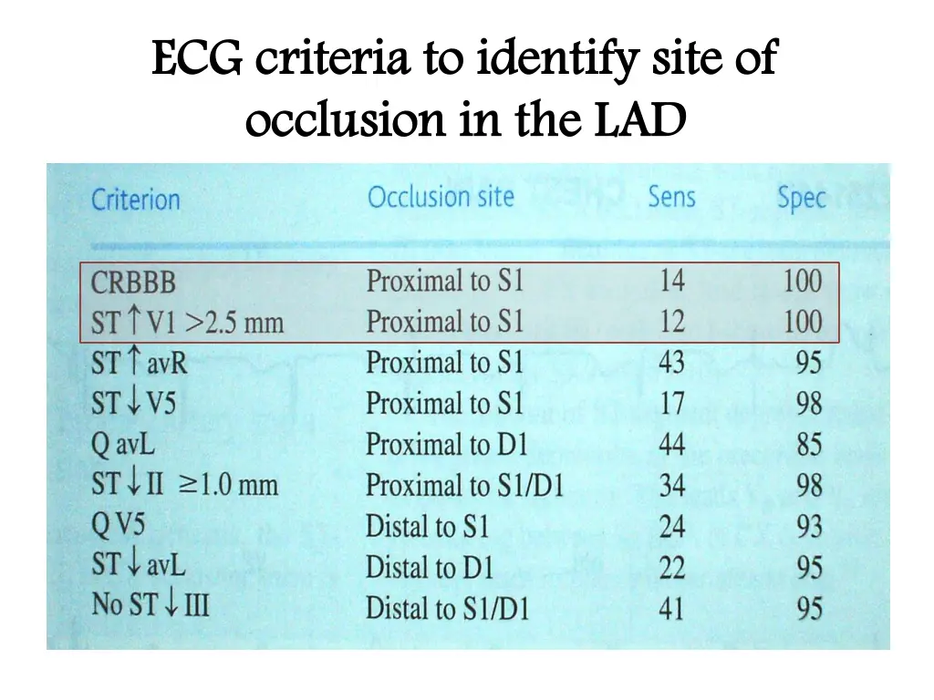 ecg criteria to identify site of ecg criteria