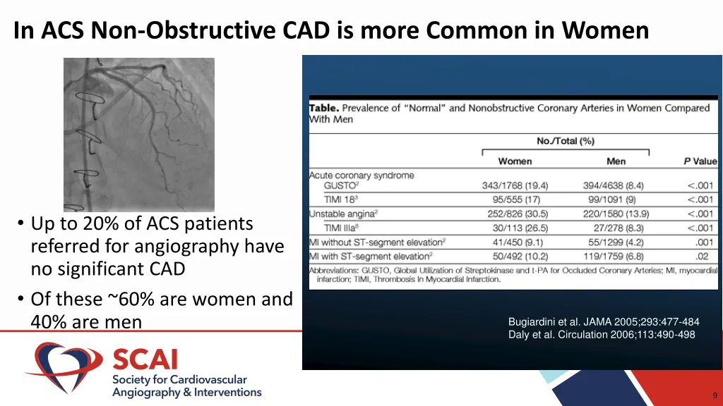 in acs non obstructive cad is more common in women