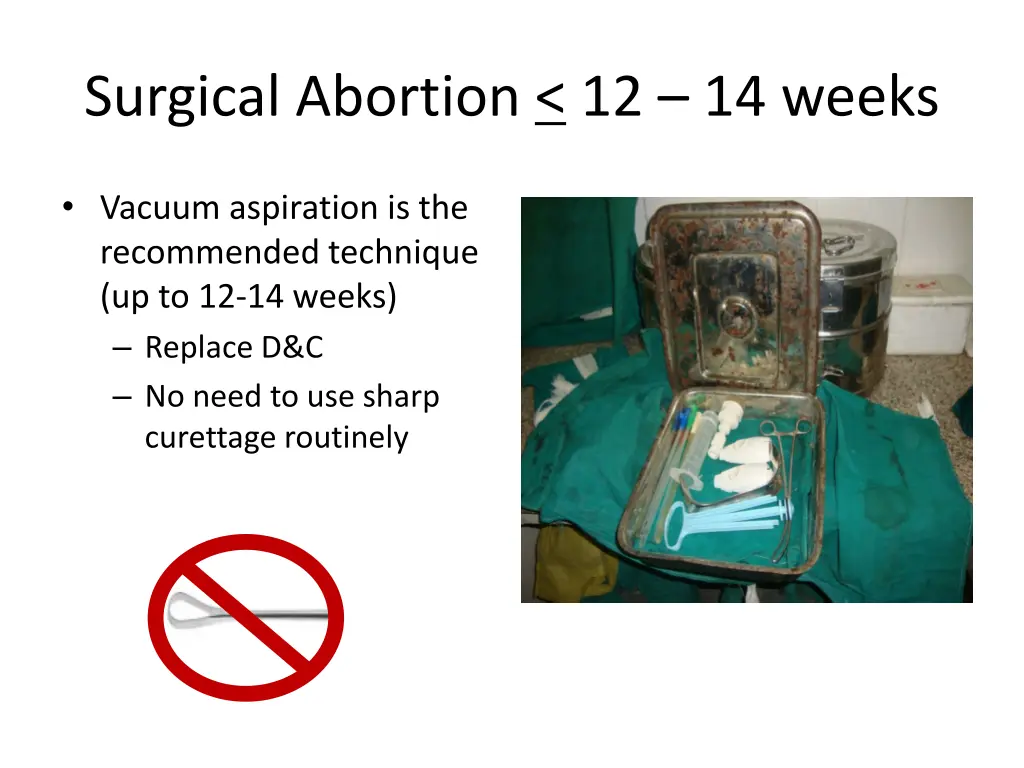 surgical abortion 12 14 weeks