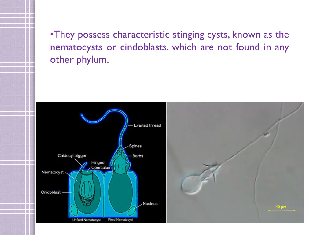 they possess characteristic stinging cysts known