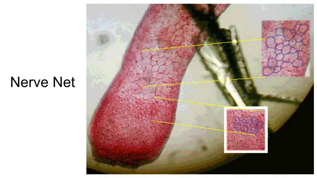 nerve net