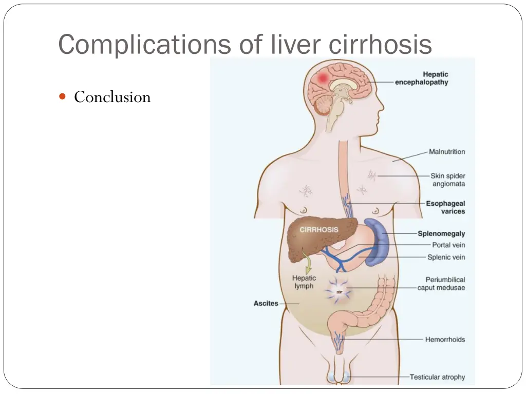 complications of liver cirrhosis 7