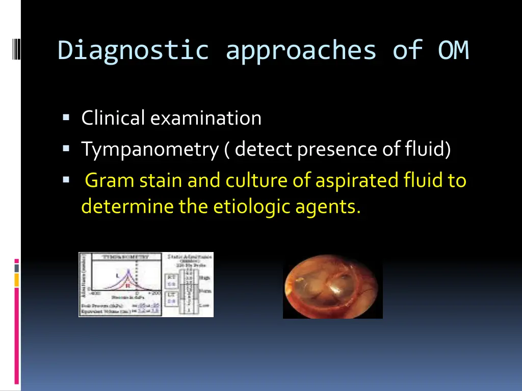 diagnostic approaches of om