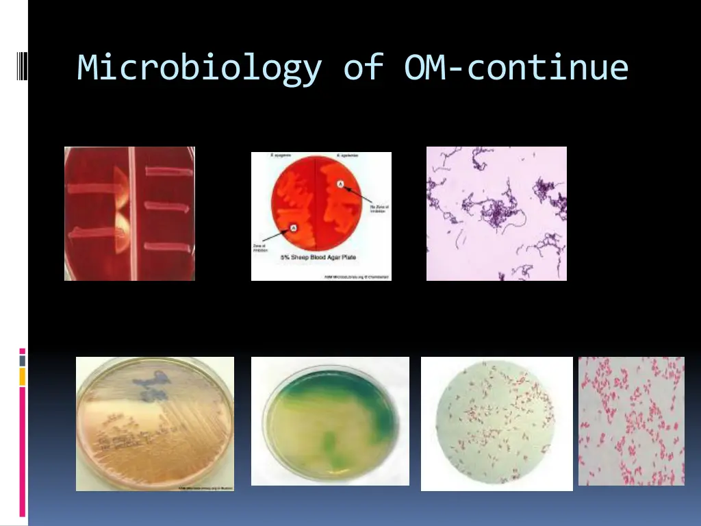 microbiology of om continue