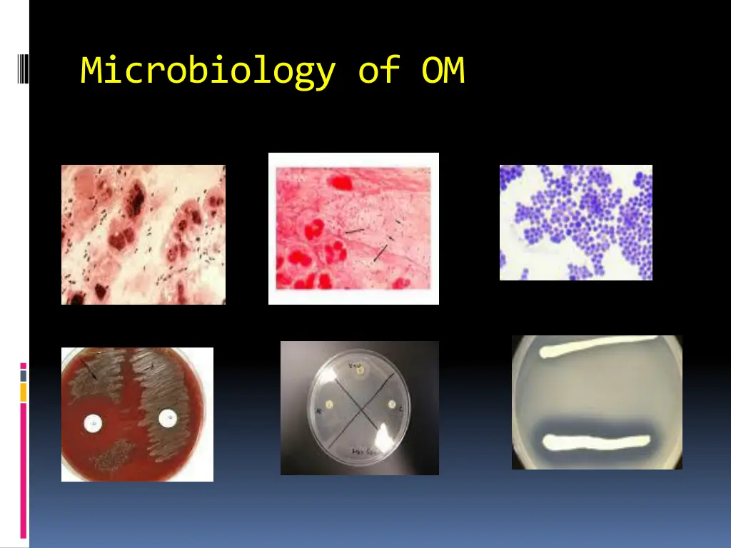 microbiology of om