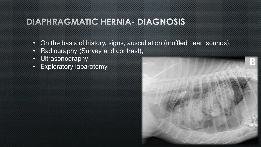 diaphragmatic hernia diagnosis